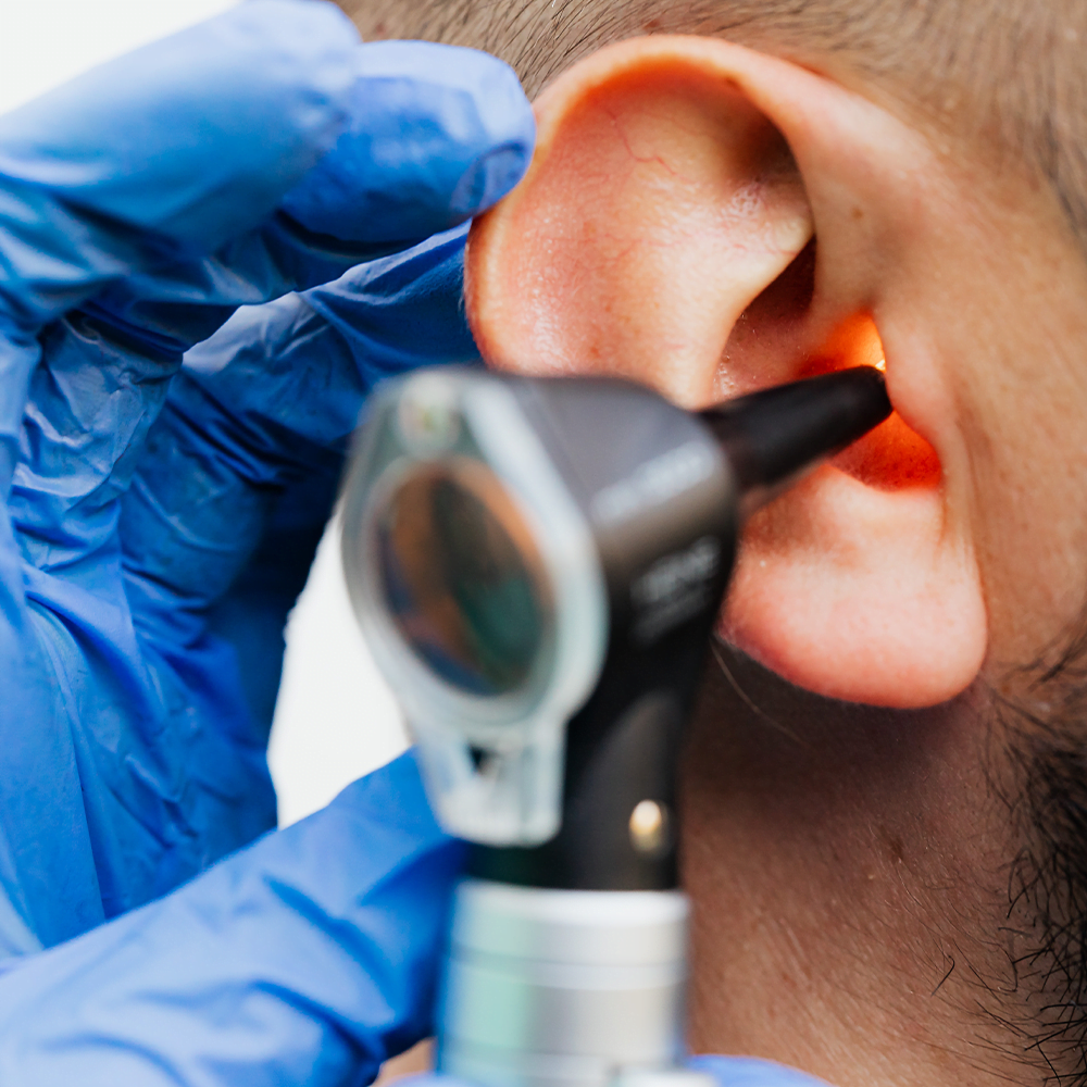 Read more about the article What Are the Different Methods of Professional Earwax Removal?