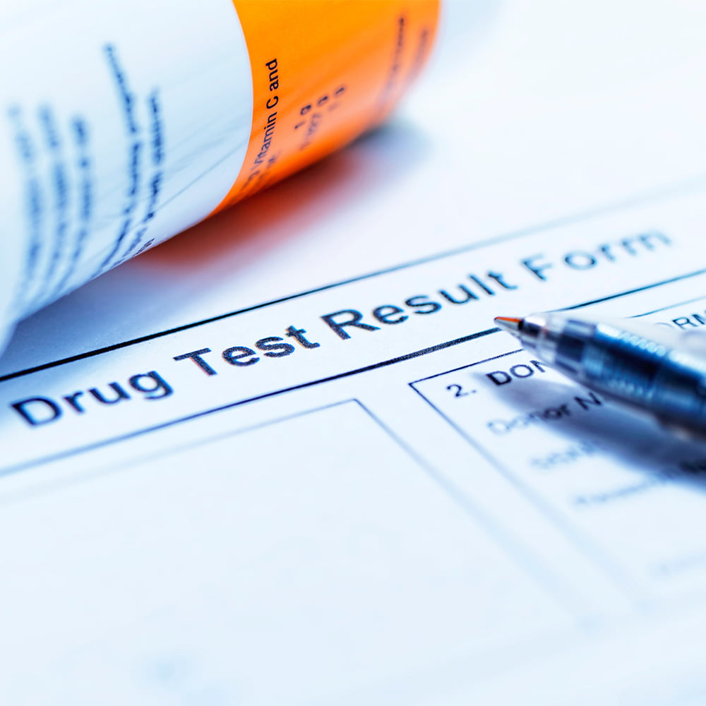 Pen placed on top of drug test result form (closeup)